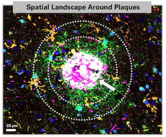 Spatial Landscape around Alzheimers Plaques